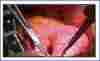 LG 27" (16:9) 8MP IPS SURGICAL, 800CD, HDMI, DP, DVI, SDI, T/BOLT, sRGB-99, DICOM, IP35, 3