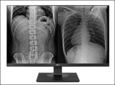 LG 27" (16:9) 8MP IPS CLINICAL, 350CD, HDMI(2), DP, sRGB-99, DICOM, H/ADJ, 3YR