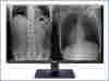 LG 27" (16:9) 8MP IPS CLINICAL, 350CD, HDMI(2), DP, sRGB-99, DICOM, H/ADJ, 3YR