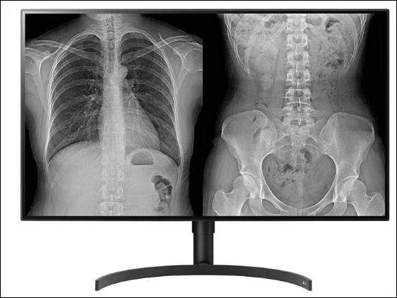 LG 32" (16:9) 8MP IPS DIAGNOSTIC, 450CD, HDMI, DP, DICOM, CLINICAL PATHOLOGY, 5YR WTY