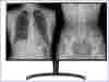 LG 32" (16:9) 8MP IPS DIAGNOSTIC, 450CD, HDMI, DP, DICOM, CLINICAL PATHOLOGY, 5YR WTY